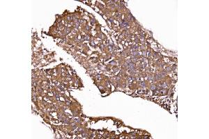 IHC analysis of GPR54/KISS1R using anti-GPR54/KISS1R antibody (ABIN7602153). (KISS1R antibody  (AA 60-373))