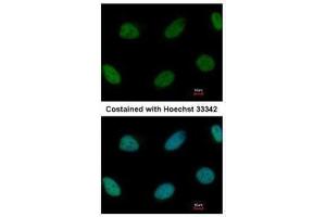 ICC/IF Image Immunofluorescence analysis of paraformaldehyde-fixed HeLa, using ZEB1, antibody at 1:1000 dilution. (ZEB1 antibody)
