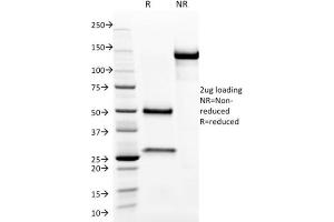 SDS-PAGE Analysis Purified Aurora B Mouse Monoclonal Antibody (AURKB/1593). (Aurora Kinase B antibody  (AA 89-251))