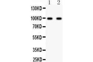 Anti- GRIA2 antibody, Western blotting All lanes: Anti GRIA2  at 0.