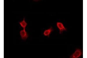 ABIN6276012 staining Hela by IF/ICC. (GPR144 antibody)