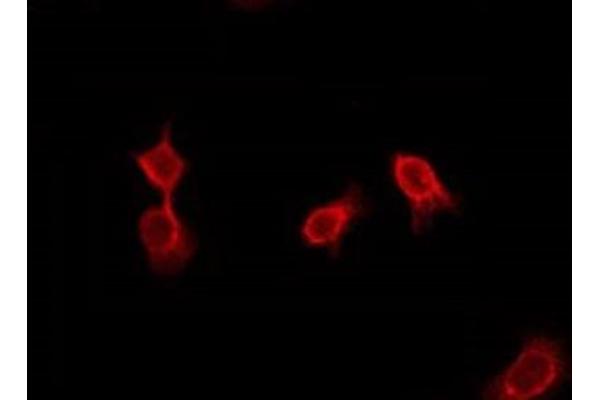 GPR144 antibody