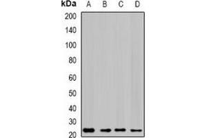 Western blot analysis of GTL3 expression in SKOV3 (A), HepG2 (B), mouse liver (C), rat lung (D) whole cell lysates. (C16orf80 antibody)