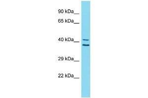 Host:  Rabbit  Target Name:  ZNF414  Sample Type:  Stomach Tumor lysates  Antibody Dilution:  1. (ZNF414 antibody  (C-Term))
