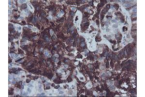 Immunohistochemistry (IHC) image for anti-alpha-2-HS-Glycoprotein (AHSG) antibody (ABIN1496502) (Fetuin A antibody)