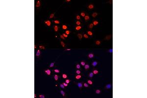 Immunofluorescence analysis of C6 cells using TriMethyl-Histone H3-K27 antibody (ABIN7267698) at dilution of 1:25. (Histone 3 antibody  (H3K27me3))