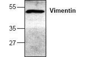 Image no. 1 for anti-Vimentin (VIM) antibody (ABIN127264) (Vimentin antibody)
