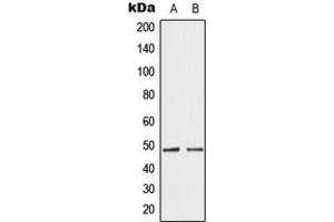 Western blot analysis of GATA4 expression in HepG2 (A), HeLa (B) whole cell lysates. (GATA4 antibody  (Center))