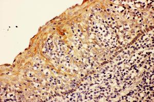 Anti- CASP8 antibody,IHC(P) IHC(P): Human Tonsil Tissue (Caspase 8 antibody  (N-Term))