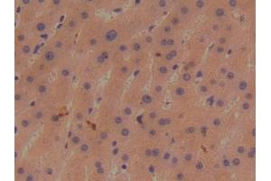 Detection of BMP1 in Human Liver Tissue using Polyclonal Antibody to Bone Morphogenetic Protein 1 (BMP1) (BMP1 antibody  (AA 610-843))