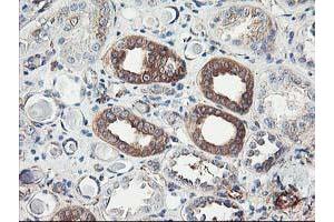 Immunohistochemical staining of paraffin-embedded Human Kidney tissue using anti-CDKN3 mouse monoclonal antibody. (CDKN3 antibody)