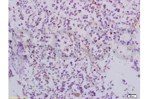Formalin-fixed and paraffin embedded mouse lymphoma tissue labeled with Anti-TRAF3/CD40bp Polyclonal Antibody, Unconjugated (ABIN738921) at 1:200 followed by conjugation to the secondary antibody and DAB staining (TRAF3 antibody  (AA 101-200))