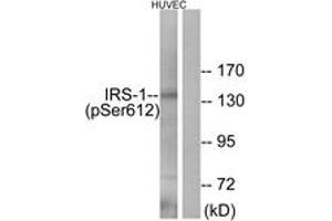 Western blot analysis of extracts from HuvEc cells treated with insulin 0. (IRS1 antibody  (pSer616))