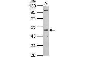 WB Image Cannabinoid Receptor 1 antibody [C1C2], Internal detects CNR1 protein by Western blot analysis. (CNR1 antibody  (C-Term))