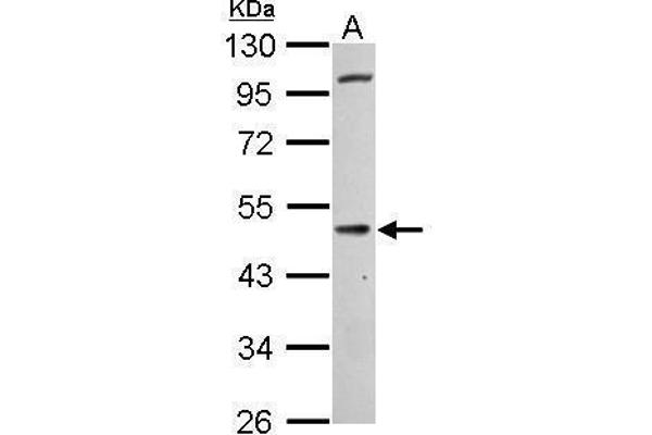 CNR1 anticorps  (C-Term)