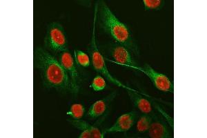 IF analysis of SFPQ using anti-SFPQ antibody (ABIN7603089) and anti-Tubulin Alpha antibody (ABIN7600339).