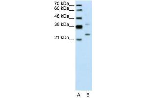DCUN1D1 antibody used at 0. (DCUN1D1 antibody)