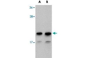 Western blot analysis of NDUFAF2 in Raji cell lysate with NDUFAF2 polyclonal antibody  at (A) 1 and (B) 2 ug/mL . (NDUFAF2 antibody  (C-Term))