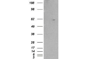 HEK293 overexpressing RXRB and probed with ABIN2559796 (mock transfection in first lane). (Retinoid X Receptor beta antibody  (Internal Region))