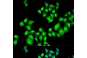 Immunofluorescence analysis of U2OS cells using DRD3 Polyclonal Antibody (DRD3 antibody)