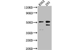 Western Blot Positive WB detected in: K562 whole cell lysate, 293 whole cell lysate All lanes: Caspase-2 antibody at 1:1000 Secondary Goat polyclonal to rabbit IgG at 1/50000 dilution Predicted band size: 51, 35, 11 kDa Observed band size: 51 kDa (Recombinant Caspase 2 antibody)