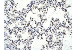Immunohistochemistry (IHC) image for anti-SWI/SNF Related, Matrix Associated, Actin Dependent Regulator of Chromatin, Subfamily D, Member 3 (SMARCD3) (N-Term) antibody (ABIN2776387)