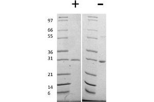 SDS-PAGE of Human Galectin-3 Recombinant Protein SDS-PAGE of Human Galectin-3 Recombinant Protein. (Galectin 3 Protein (LGALS3))