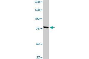 RPS6KA1 monoclonal antibody (M02), clone 4E11.