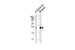 Western blot analysis of lysates from human placenta and heart tissue lysates (from left to right), using FRAT2 Antibody (C-term) (ABIN655793 and ABIN2845223). (FRAT2 antibody  (C-Term))