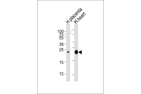 FRAT2 antibody  (C-Term)