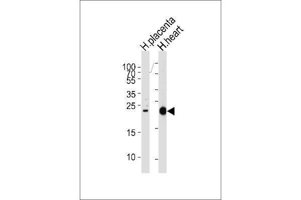 FRAT2 anticorps  (C-Term)