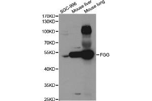 Western blot analysis of extracts of various cell lines, using FGG antibody. (FGG antibody)