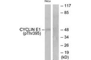 Western blot analysis of extracts from HeLa cells treated with Paclitaxel 1uM 60', using Cyclin E1 (Phospho-Thr395) Antibody.