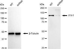 Western blotting analysis using IFIH1 antibody (ABIN7799084). (Recombinant IFIH1 antibody)