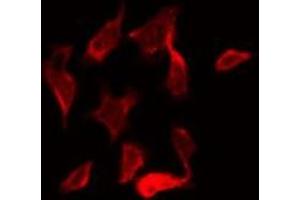 ABIN6269408 staining NIH-3T3 by IF/ICC. (CaMK2 alpha/delta antibody)