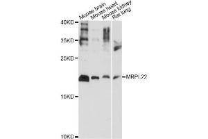 Western blot analysis of extracts of various cell lines, using MRPL22 antibody (ABIN6292563) at 1:1000 dilution. (MRPL22 antibody)