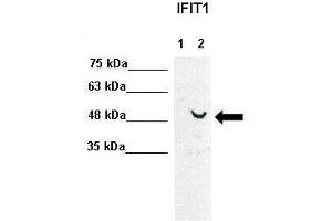 WB Suggested Anti-IFIT1 Antibody  Positive Control: Lane1: 30ug human Huh7, Lane2: 30ug human Huh7+IFNB stimulated  Primary Antibody Dilution :  1:1000 Secondary Antibody :  Anti-rabbit-HRP  Secondry Antibody Dilution :  1:5000 Submitted by: Takeshi Saito, USC Keck School of Medicine (IFIT1 antibody  (C-Term))