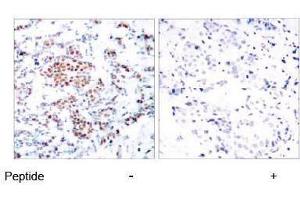 Image no. 1 for anti-Signal Transducer and Activator of Transcription 5A (STAT5A) (Tyr694) antibody (ABIN197180) (STAT5A antibody  (Tyr694))