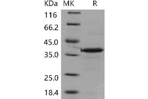 Western Blotting (WB) image for Carbonic Anhydrase VIII (CA8) (Active) protein (His tag) (ABIN7320152) (CA8 Protein (His tag))