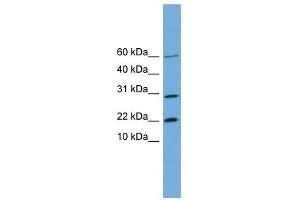 PRR13 antibody used at 1 ug/ml to detect target protein. (Proline Rich 13 antibody  (N-Term))
