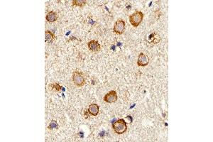 Immunohistochemical analysis of paraffin-embedded M. (Myosin antibody  (AA 654-668))