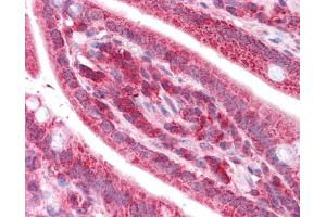 TST antibody was used for immunohistochemistry at a concentration of 4-8 ug/ml. (TST antibody)