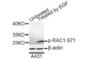 Western blot analysis of extracts of A-431 cells, using Phospho-RAC1-S71 antibody (ABIN5969930) at 1/1000 dilution. (RAC1 antibody  (pSer71))