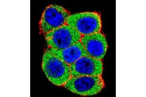 Immunofluorescence (IF) image for anti-Ubiquitin Protein Ligase E3A (ube3a) antibody (ABIN3001484) (ube3a antibody)