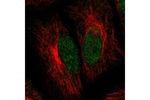 Immunofluorescent staining of HeLa cells with ATRX monoclonal antibody, clone CL0537  (Green) shows clear nuclear (without nucleoli) staining.
