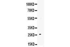 Anti-TREM1 antibody, Western blotting Lane 1: Recombinant Mouse TREM1 Protein 1ng (TREM1 antibody  (AA 74-90))