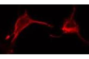 ABIN6278558 staining  Hela cells by IF/ICC. (CD2BP2 antibody  (Internal Region))