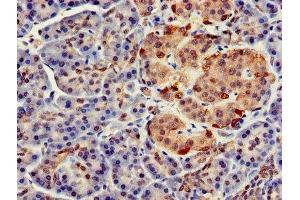 Immunohistochemistry of paraffin-embedded human pancreatic tissue using ABIN7152694 at dilution of 1:100 (FARP2 antibody  (AA 261-550))