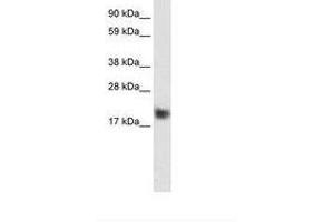 Image no. 1 for anti-Cysteine and Glycine-Rich Protein 3 (CSRP3) (C-Term) antibody (ABIN6735943) (CSRP3 antibody  (C-Term))