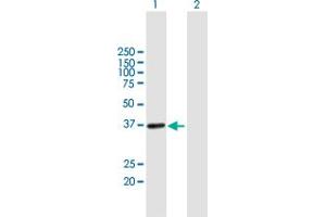 Western Blot analysis of UPRT expression in transfected 293T cell line by UPRT MaxPab polyclonal antibody. (UPRT antibody  (AA 1-309))